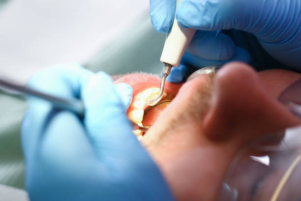 Best Mobile Emergency Dentist in Melville, NY